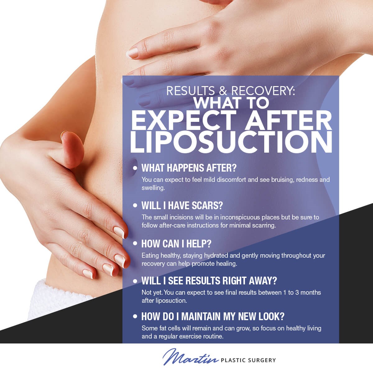 Liposuction